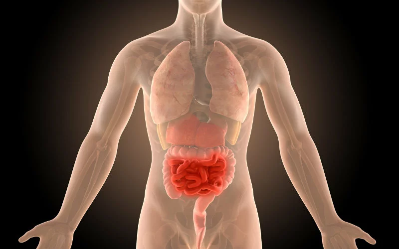 Νόσος Crohn: Εντοπίστηκε νέος παράγοντας ύποπτος για τη φλεγμονή του εντέρου – Ελπίδα για αποτελεσματικές θεραπείες