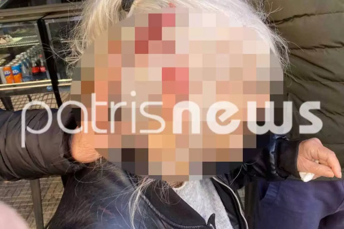 Πύργος: Λήστεψαν ηλικιωμένη μέρα – μεσημέρι και την έστειλαν στο νοσοκομείο