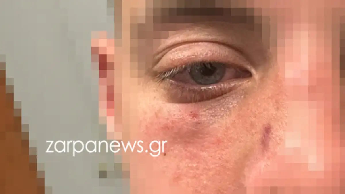 Χανιά: Άνδρας επιτέθηκε με μπουνιές σε ανήλικα παιδιά επειδή έκαναν φασαρία μέσα στο σινεμά