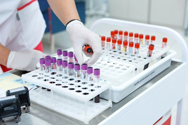 Άφαντα 323 φιαλίδια με θανατηφόρους ιούς από εργαστήριο στην Αυστραλία – Κανείς δεν ξέρει που είναι
