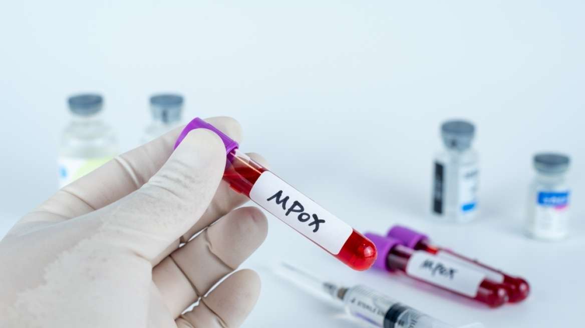 Η παγκόσμια συχνότητα εμφάνισης του ιού mpox ξεπερνά τα 117.000 κρούσματα