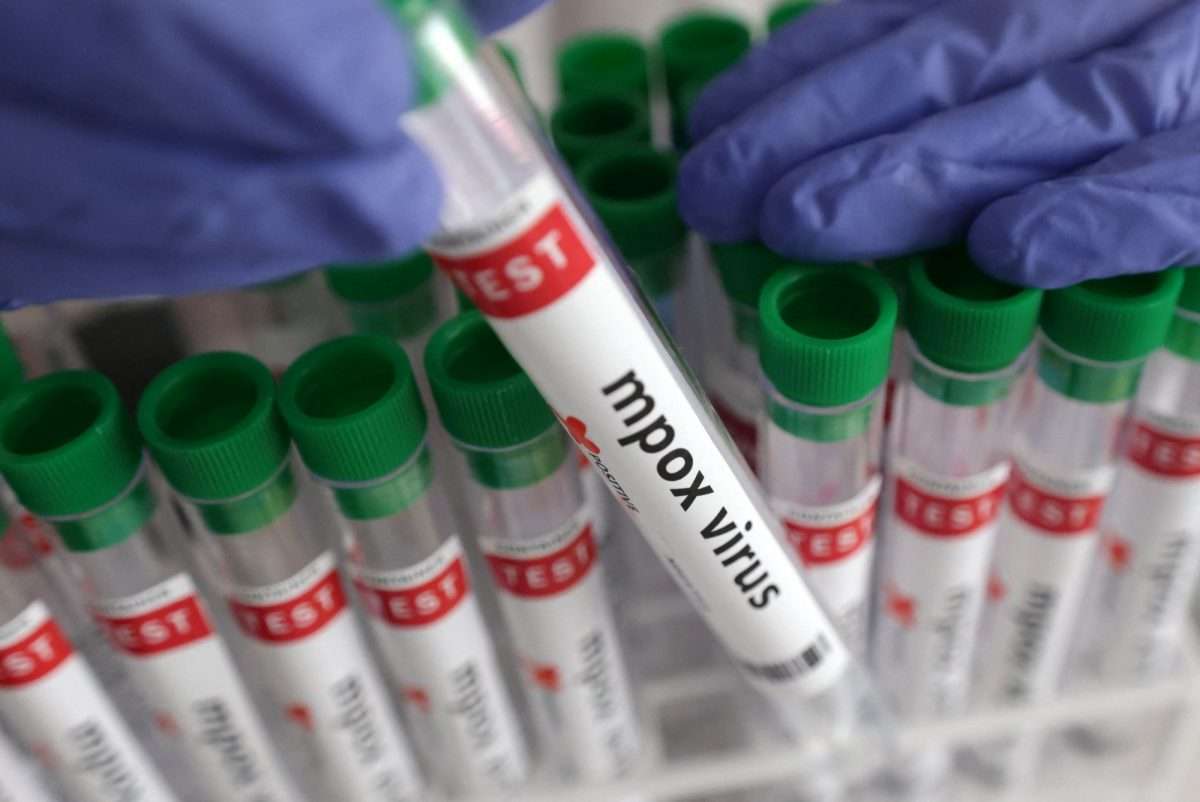 Εξαπλώνονται τα κρούσματα της ευλογιάς των πιθήκων στην Ελλάδα