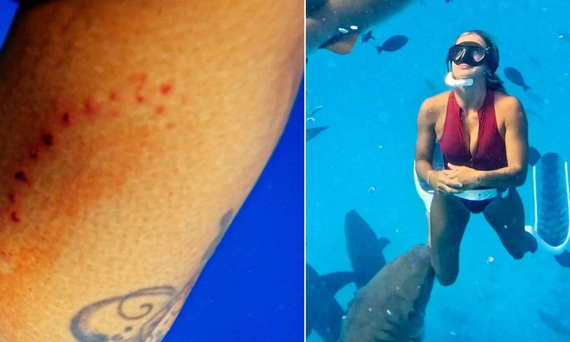 Καρχαρίας δαγκώνει το πόδι influencer – 18 εκατομμύρια προβολές