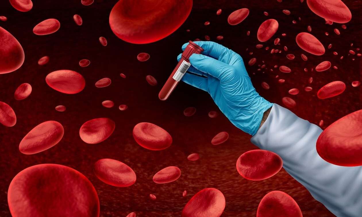 Τεστ αίματος μπορεί να ανιχνεύσει τα πρώιμα σημάδια καρδιακής προσβολής μέσα σε 5-7 λεπτά