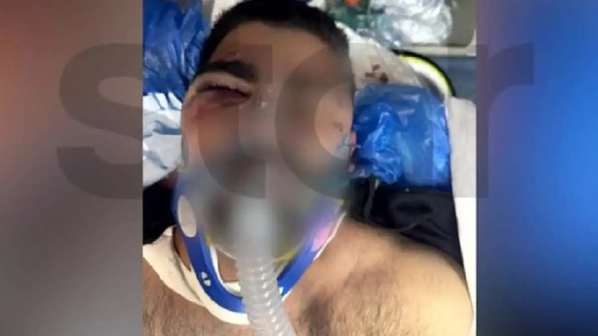 ΚΟΙΝΩΝΙΚΟ-ΣΟΚ: 20χρονος ξυλοκοπήθηκε άγρια με ασύρματο από αστυνομικούς – Η μητέρα δεν τον αναγνώρισε!