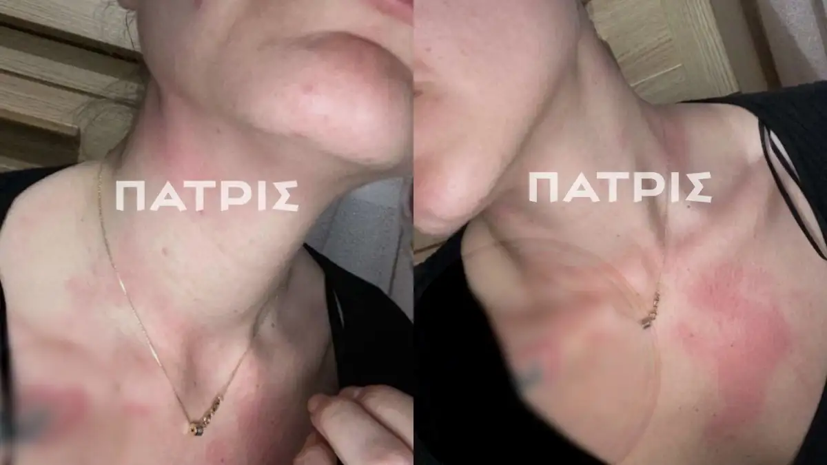 «Έχω panic button και είμαι ΑΠΡΟΣΤΑΤΕΥΤΗ» – Η ΕΛ.ΑΣ. άφαντη για 30 λεπτά!