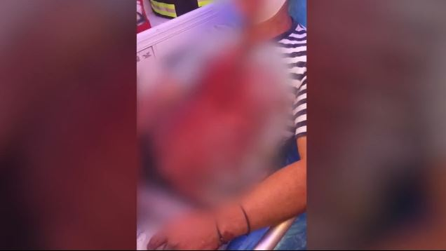 Τοξικομανής μαχαίρωσε υπάλληλο του δήμου μπροστά στο Αρχαιολογικό Μουσείο!
