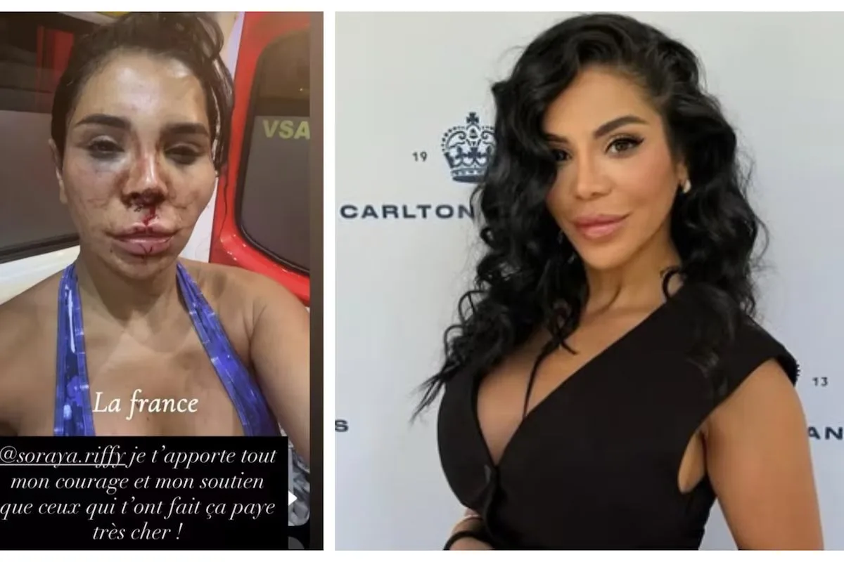 «Άγρια ληστεία» σε σπίτι Influencer – Την έδεσαν, τη χτύπησαν και την κάλυψαν με χλωρίνη