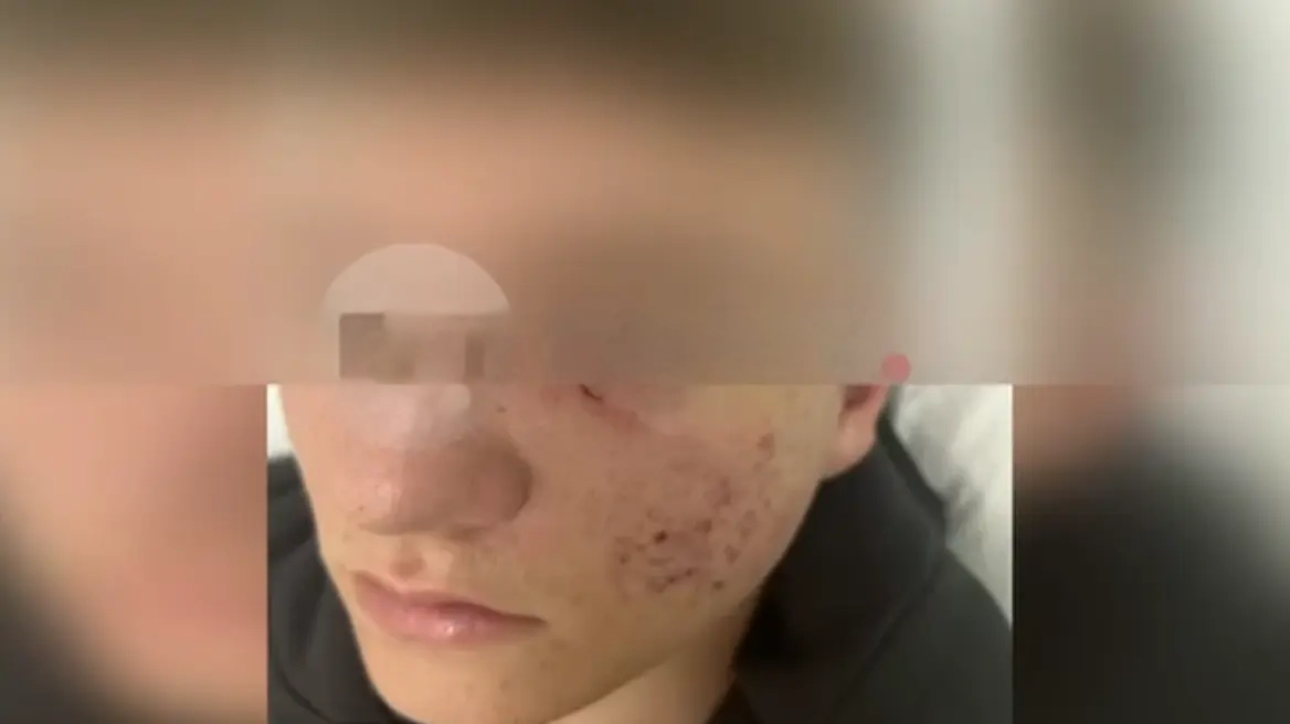 Σοκ στην Ξάνθη: 15χρονος ξυλοκοπήθηκε μετά από παγίδα – «Έφαγες ξύλο αγόρι μου;» του έστειλαν μήνυμα