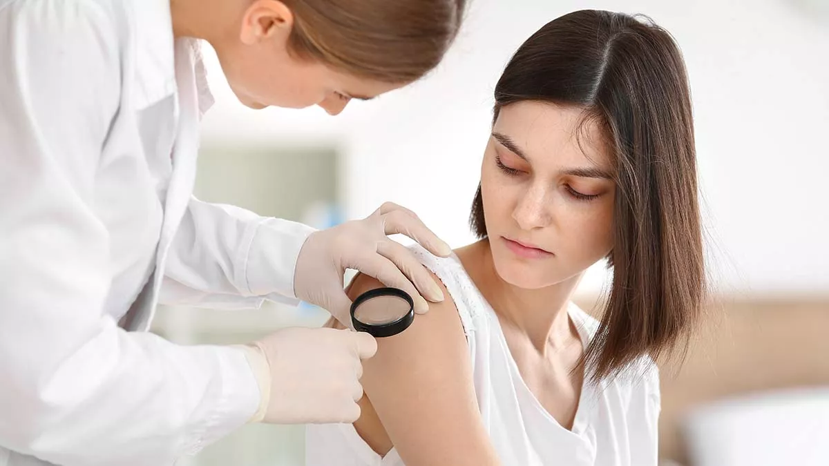 Μελάνωμα: Οι 6 ύποπτες αλλαγές στους σπίλους που δεν πρέπει να αγνοήσουμε