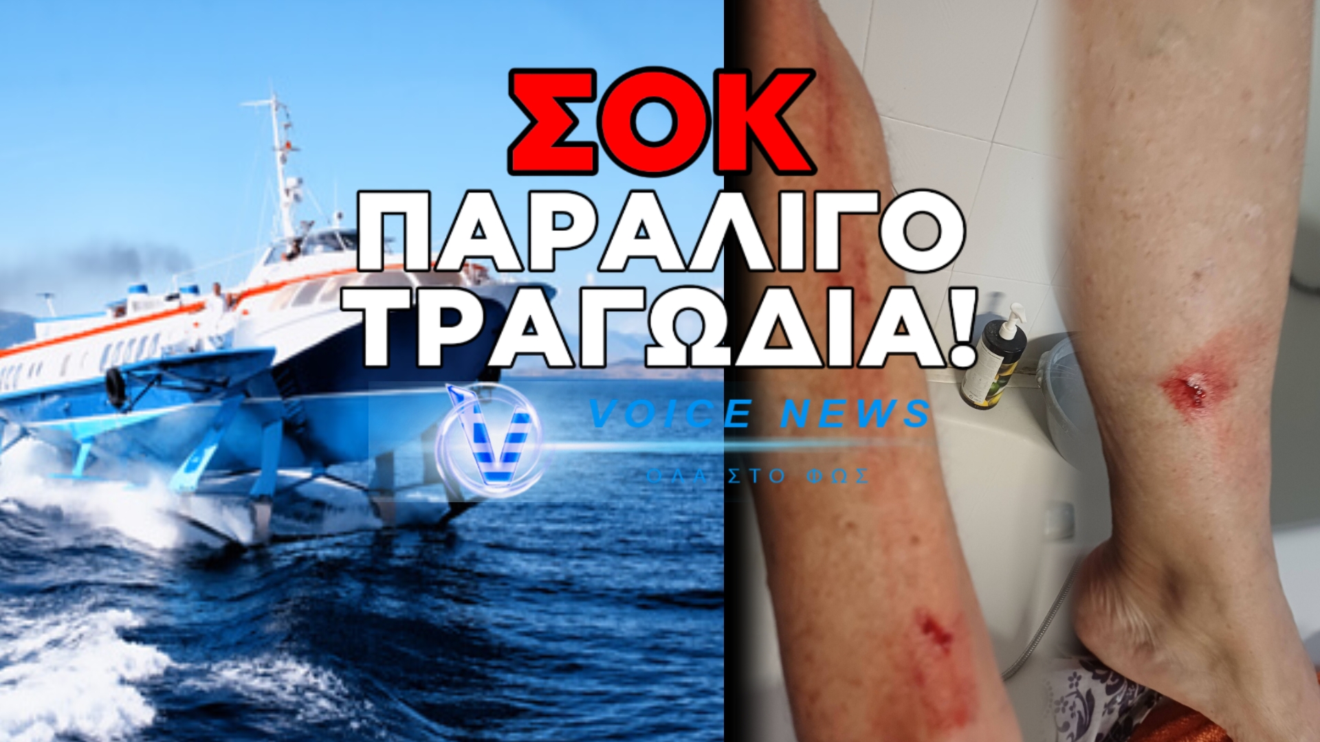 ΠΛΟΙΟ ΤΗΣ ΓΡΑΜΜΗΣ ΔΙΕΡΧΟΜΕΝΟ ΜΕ ΜΕΓΑΛΗ ΤΑΧΥΤΗΤΑ ΠΕΤΑΞΕ ΛΟΥΟΜΕΝΗ ΣΤΑ ΒΡΑΧΙΑ