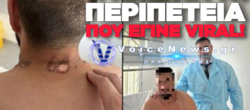 ΡΩΣΟΣ ΠΕΖΟΝΑΥΤΗΣ ΕΠΕΖΗΣΕ ΑΠΟ ΚΕΡΑΥΝΟ, ΑΡΚΟΥΔΑ ΚΑΙ ΠΑΡΑΛΥΣΗ: Η ΑΠΙΣΤΕΥΤΗ ΙΣΤΟΡΙΑ ΕΠΙΒΙΩΣΗΣ ΠΟΥ ΓΙΝΕΤΑΙ VIRAL!