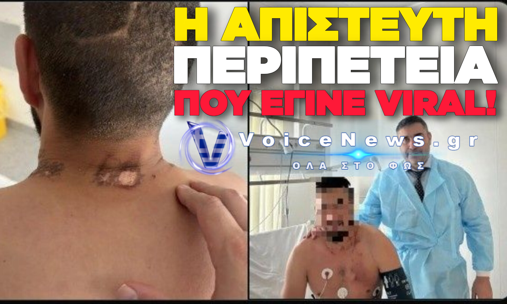 ΡΩΣΟΣ ΠΕΖΟΝΑΥΤΗΣ ΕΠΕΖΗΣΕ ΑΠΟ ΚΕΡΑΥΝΟ, ΑΡΚΟΥΔΑ ΚΑΙ ΠΑΡΑΛΥΣΗ: Η ΑΠΙΣΤΕΥΤΗ ΙΣΤΟΡΙΑ ΕΠΙΒΙΩΣΗΣ ΠΟΥ ΓΙΝΕΤΑΙ VIRAL!