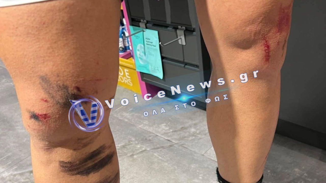 Κρυονέρι: Λύκος επιτέθηκε σε κάτοικο – «Πάλευα για τη ζωή μου 8 λεπτά»
