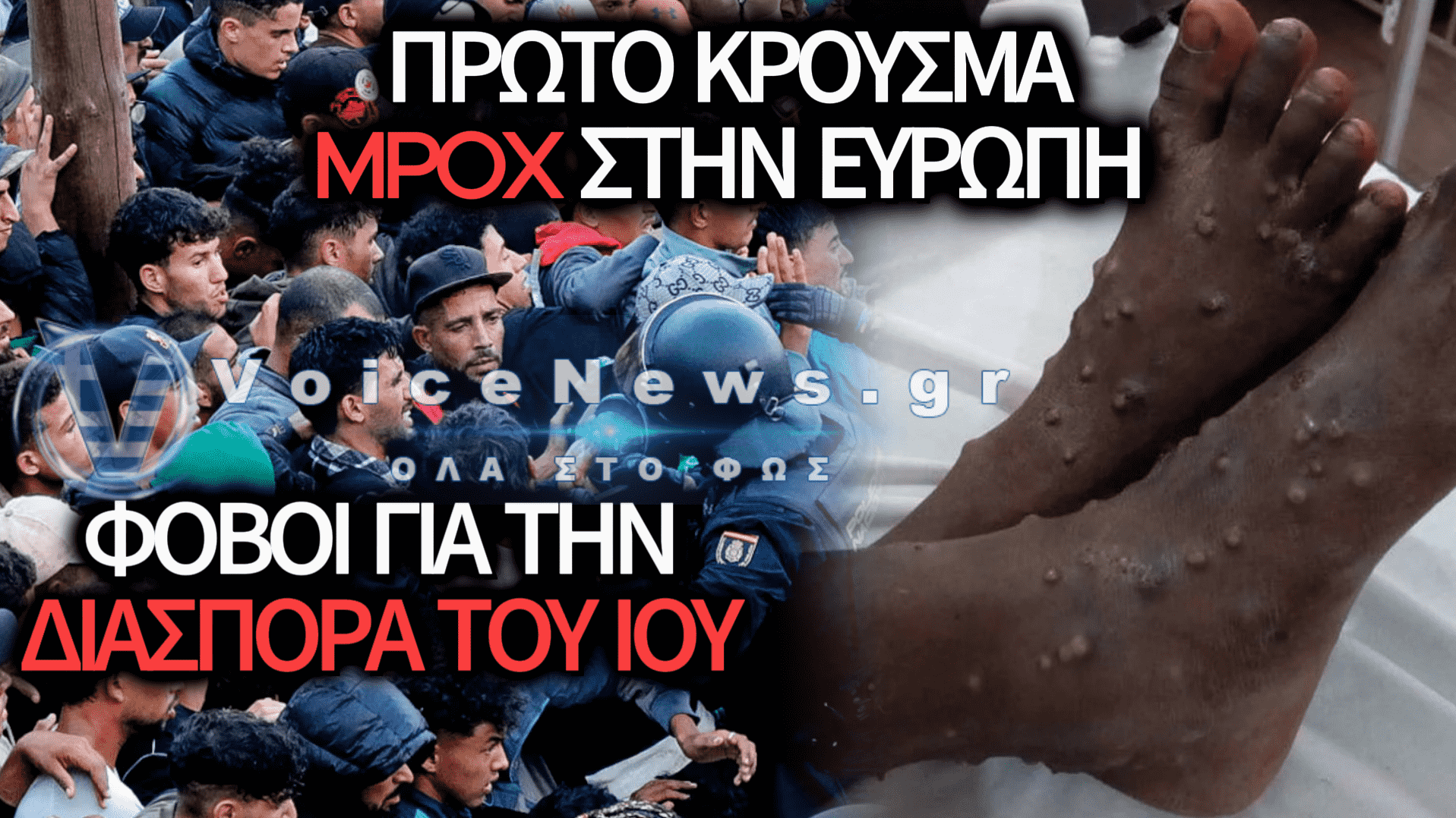 ΠΡΩΤΟ ΚΡΟΥΣΜΑ ΕΥΛΟΓΙΑΣ ΤΩΝ ΠΙΘΗΚΩΝ ΣΕ ΜΕΤΑΝΑΣΤΗ ΣΤΗΘΕΟΥΤΑ – ΣΤΗΝ ΕΛΛΑΔΑ ΘΑ ΤΟ ΜΑΘΟΥΜΕ ΑΠΟ ΤΑ ΜΜΕ ΟΤΑΝ ΚΟΛΛΗΣΕΙ ΕΛΛΗΝΑΣ;